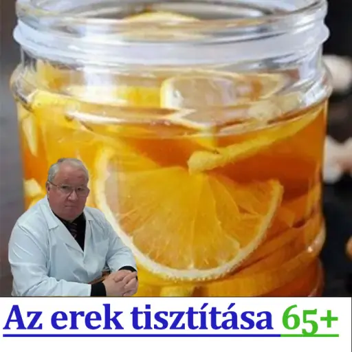 Erek tisztítása házilag. Az Erek Tisztítása szükséges az Egészséghez. További Részletek