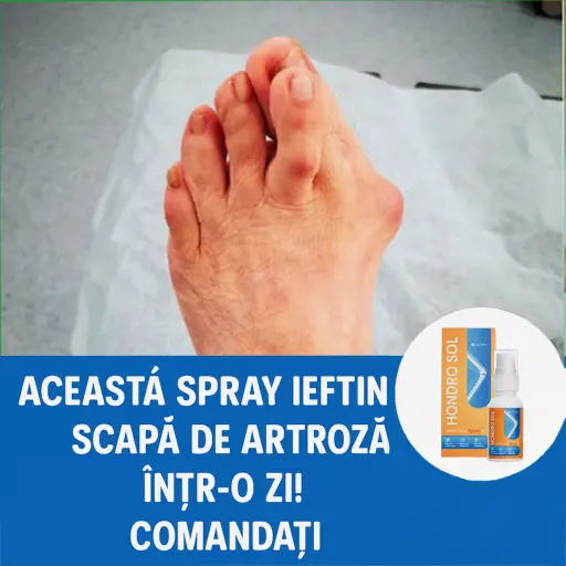 Solutia ideala pentru oase. Ameliorează durerea şi stabilizează articulația în timpul mişcării.