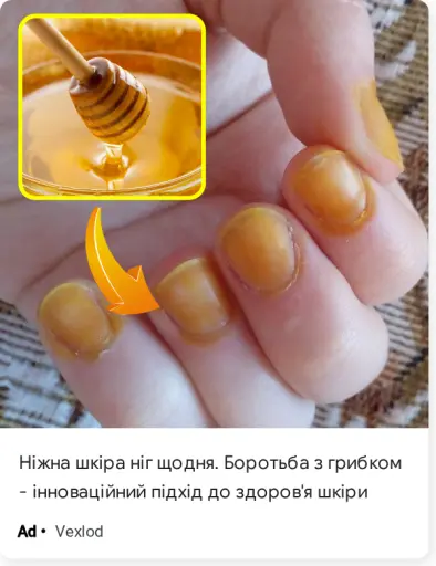 Ідеальний стан стоп